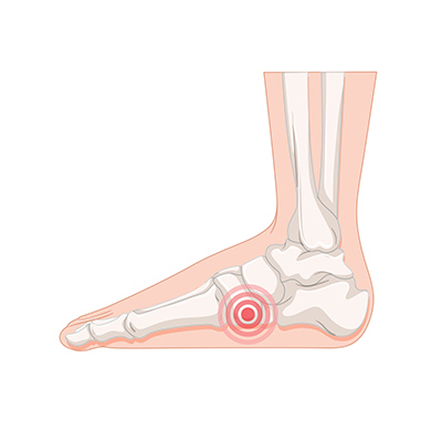 Pronation och supination